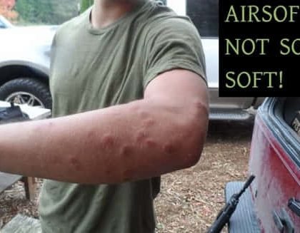 vet thuong do sung airsoft gay ra