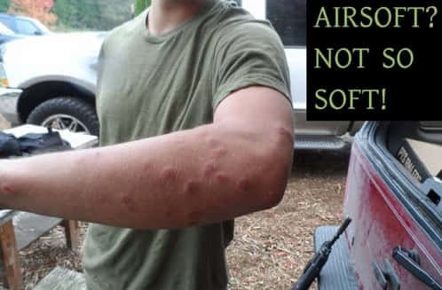 vet thuong do sung airsoft gay ra